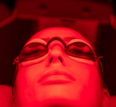 Acne Treatment Break Out at Richmont Monaco with Red LED light infrared light